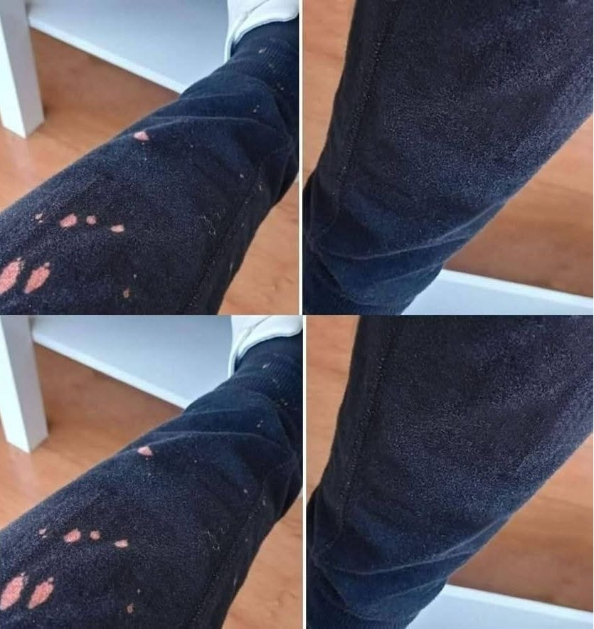 Madeži belila na vaših oblačilih? Ni jih treba zavreči: tukaj je rešitev