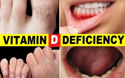 10 Signs Your Body Is Begging for Vitamin D
