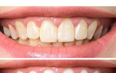 “From Yellow to White in Just 2 Minutes?”
