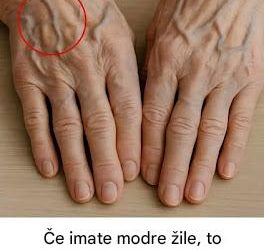 Vidne žile na rokah: zdravstveni znaki, ki jih ne smete prezreti