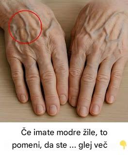 Vidne žile na rokah: zdravstveni znaki, ki jih ne smete prezreti
