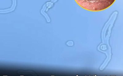 What Are Eye Floaters? Here What To Do If you Start Seeing Them, According to an Eye Doctor