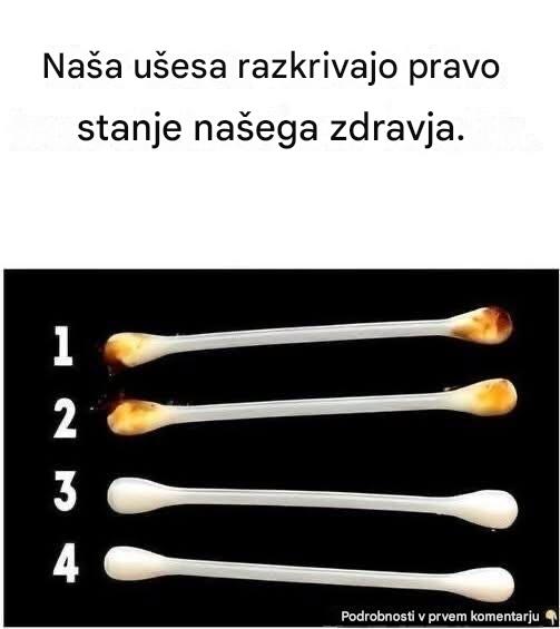 Naša ušesa razkrivajo naše resnično zdravstveno stanje