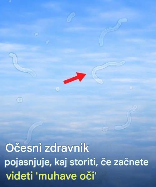Očesne mušice: kaj so in kaj storiti, če jih opazite, po mnenju oftalmologa
