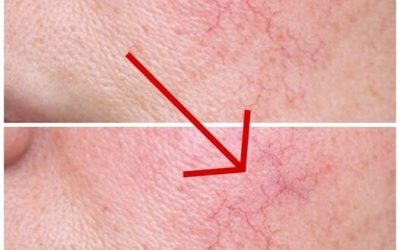 These are the first symptoms of a… See more
