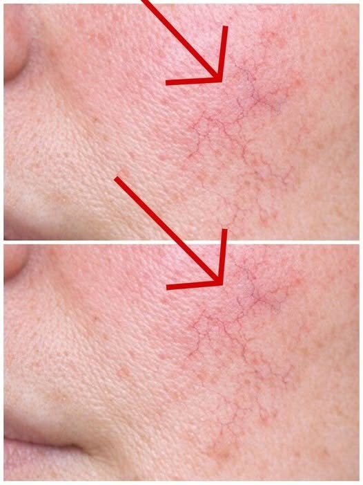 These are the first symptoms of a… See more