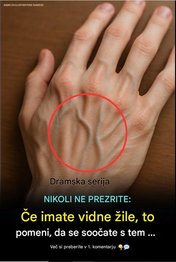 Zakaj mladi odrasli opazijo izrazite vene na rokah