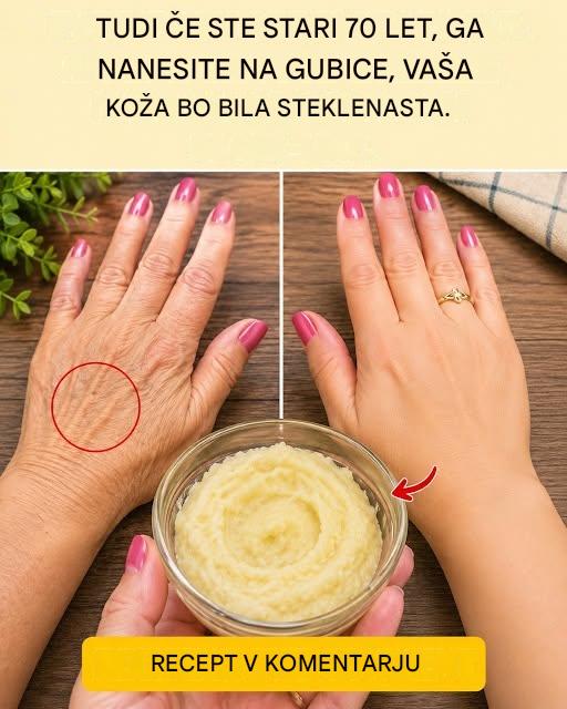 Pripravite kremo s sodo bikarbono in jo nanesite pred spanjem. Zbogom gube in nepravilnosti … glej več Če želite še naprej prejemati moje recepte, samo recite
