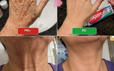 Poglej to … Te roke so bile videti stare, polne madežev … Več si preberi v prvem komentarju.