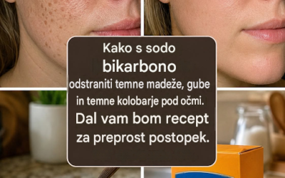 Kako uporabiti sodo bikarbono za odstranjevanje temnih madežev, gub in temnih kolobarjev z obraza.