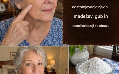Soda bikarbona za odstranjevanje zelo temnih madežev …
