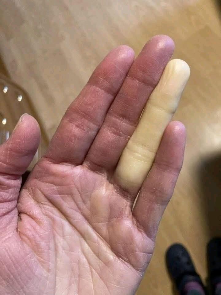 To so posledice spanja z njim/njo … Več