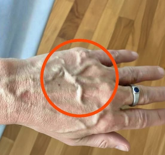 Če imate vidne žile, to pomeni, da ste … .💬👇🏻