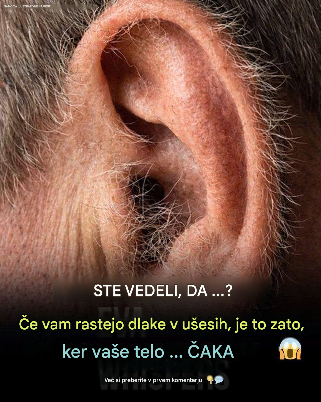 Kaj dlake v ušesih povedo o vašem zdravju