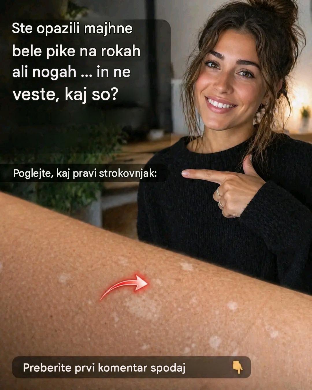 Zakaj se na koži pojavijo bele lise?🤯😱😱