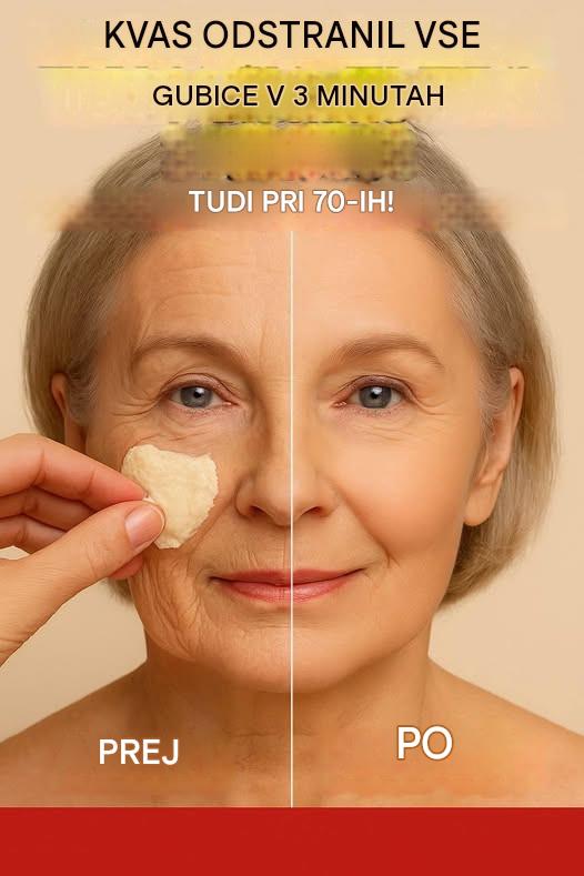 Kvas odstrani vse gube v 3 minutah. Tudi pri 70 letih. Odprava gub.