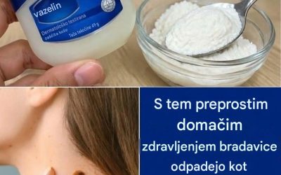 Bradavice odpadajo kot listje s tem preprostim domačim zdravljenjem