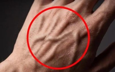 Imate zelo vidne žile na rokah, rokah ali nogah? Ta pojav je pogosto zaskrbljujoč, vendar je običajno normalen. Zakaj imajo nekateri ljudje bolj vidne žile kot drugi?
