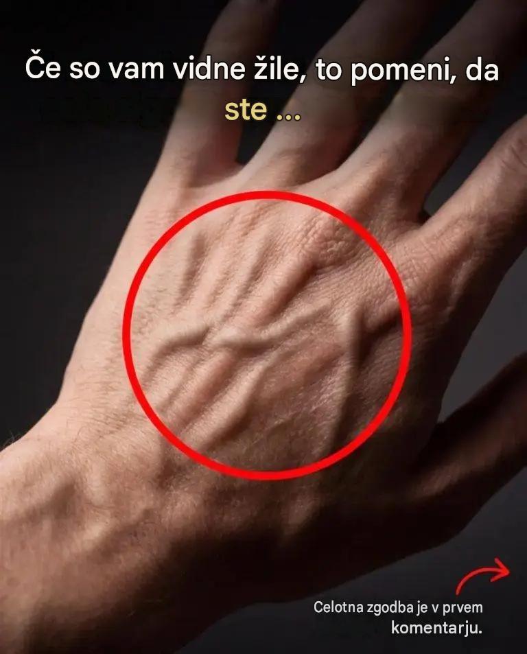 Imate zelo vidne žile na rokah, rokah ali nogah? Ta pojav je pogosto zaskrbljujoč, vendar je običajno normalen. Zakaj imajo nekateri ljudje bolj vidne žile kot drugi?